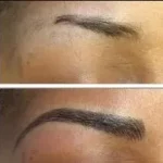 Eyebrow before and after